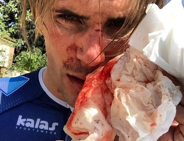 Francouzský jezdec brutálně napaden při tréninku
